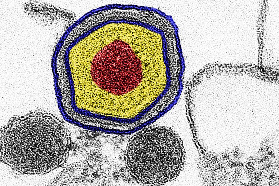 ASP Virus (© FLI, Labor für Elektronenmikroskopie; Koloration: Mandy Jörn)