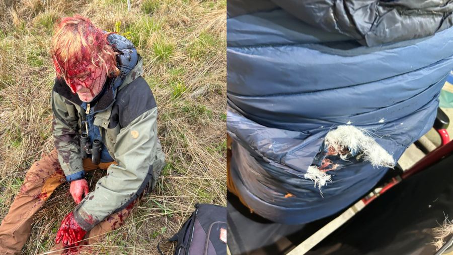 Links zu sehen ist Andreas Kieling blutüberströmt und aus Wunden am Kopf und an der Hand blutend. Rechts zu sehen seine zwerfetzte Jacke, die vielleicht Schlimmeres verhindert hat?! (Fotos: Facebookseite von Andreas Kieling/https://www.facebook.com/Andreas.Kieling/?locale=de_DE)